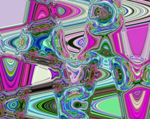 冷凍アブレーションから１日 明日、退院します。パート２の⑱