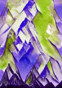 心房粗動です。カテーテルアブレーション手術を受けましょう。①