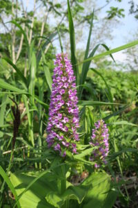 いきなり入院、カテーテルアブレーションをやるために⑧