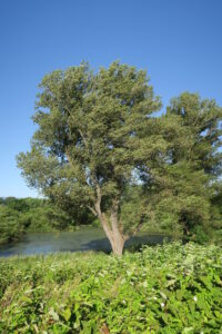 経食道心エコーこれが一番きつかった。⑩