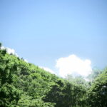 いよいよ手術当日になりました。 ⑭