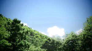 いよいよ手術当日になりました。 ⑭