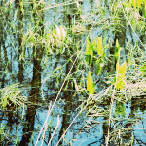 エリキュース錠5ｍｇとカルベジロール2.5ｍｇ高い パート2の②