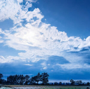 わたしの体験談、不整脈の原因とアブレーション